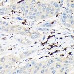 Coronin 1A Polyclonal Antibody