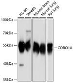 Coronin 1A Antibody in Western Blot (WB)