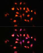 PHLPP1 Polyclonal Antibody