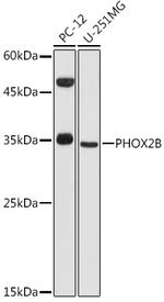 PHOX2B Polyclonal Antibody