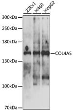 COL4A5 Antibody in Western Blot (WB)