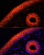 Desmoglein 1 Polyclonal Antibody