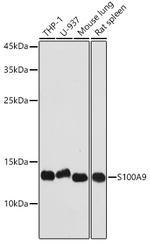 S100A9 Antibody in Western Blot (WB)