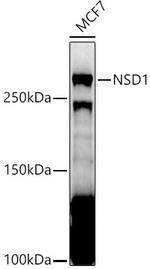 NSD1 Polyclonal Antibody
