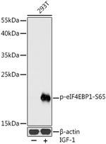 Phospho-4EBP1 (Ser65) Antibody in Western Blot (WB)
