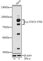 Phospho-STAT3 (Tyr705) Antibody in Western Blot (WB)