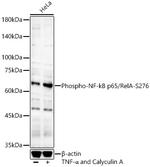 Phospho-NFkB p65 (Ser276) Antibody in Western Blot (WB)