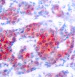 Phospho-STAT4 (Tyr693) Polyclonal Antibody