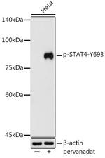 Phospho-STAT4 (Tyr693) Antibody in Western Blot (WB)