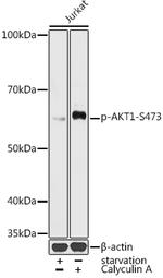 Phospho-AKT1 (Ser473) Antibody in Western Blot (WB)
