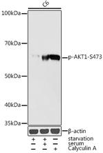 Phospho-AKT1 (Ser473) Antibody in Western Blot (WB)