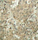 Phospho-Cofilin (Ser3) Antibody in Immunohistochemistry (Paraffin) (IHC (P))