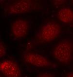 Phospho-PKC alpha/beta-2 (Thr638, Thr641) Polyclonal Antibody