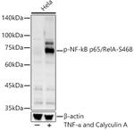 Phospho-NFkB p65 (Ser468) Polyclonal Antibody