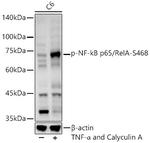 Phospho-NFkB p65 (Ser468) Antibody in Western Blot (WB)