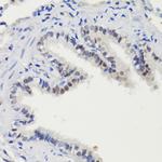 Phospho-STAT3 (Ser727) Antibody in Immunohistochemistry (Paraffin) (IHC (P))