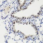 Phospho-STAT3 (Ser727) Antibody in Immunohistochemistry (Paraffin) (IHC (P))