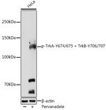 Phospho-TrkA/TrkB (Tyr674, Tyr675, Tyr706, Tyr707) Polyclonal Antibody