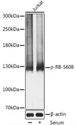 Phospho-Rb (Ser608) Antibody in Western Blot (WB)
