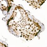 Phospho-ATR (Ser428) Antibody in Immunohistochemistry (Paraffin) (IHC (P))