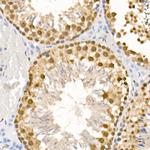 Phospho-ATR (Ser428) Antibody in Immunohistochemistry (Paraffin) (IHC (P))
