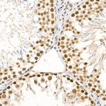 Phospho-ATR (Ser428) Antibody in Immunohistochemistry (Paraffin) (IHC (P))