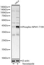 Phospho-NPM1 (Thr199) Antibody in Western Blot (WB)