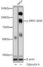 Phospho-DNM1L (Ser616) Antibody in Western Blot (WB)