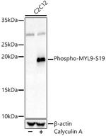 Phospho-MYL9 (Ser19) Polyclonal Antibody