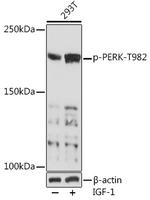 Phospho-PERK (Thr982) Polyclonal Antibody