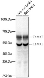 Phospho-PERK (Thr982) Antibody in Western Blot (WB)