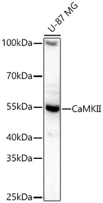 Phospho-PERK (Thr982) Antibody in Western Blot (WB)