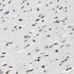 Phospho-STAT5A/B (Tyr694) Antibody in Immunohistochemistry (Paraffin) (IHC (P))