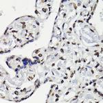 Phospho-STAT5A/B (Tyr694) Polyclonal Antibody