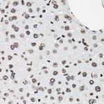 Phospho-STAT5A/B (Tyr694) Antibody in Immunohistochemistry (Paraffin) (IHC (P))