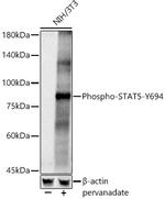Phospho-STAT5A/B (Tyr694) Antibody in Western Blot (WB)