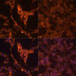 Phosphotyrosine Antibody in Immunocytochemistry (ICC/IF)