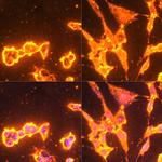 Phosphotyrosine Antibody in Immunocytochemistry (ICC/IF)