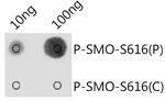 Phospho-SMO (Ser616) Polyclonal Antibody