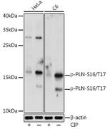Phospho-Phospholamban (Ser16, Thr17) Polyclonal Antibody