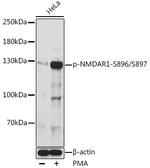 Phospho-NMDAR1 (Ser896, Ser897) Polyclonal Antibody