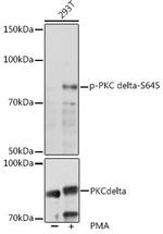 Phospho-PKC delta (Ser645) Polyclonal Antibody