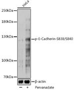 Phospho-E-cadherin (Ser838, Ser840) Antibody in Western Blot (WB)