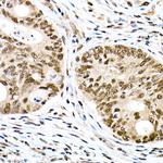 Phospho-FOXO1 (Ser319) Polyclonal Antibody