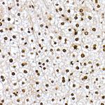 Phospho-FOXO1 (Ser319) Antibody in Immunohistochemistry (Paraffin) (IHC (P))