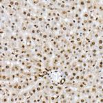 Phospho-FOXO1 (Ser319) Antibody in Immunohistochemistry (Paraffin) (IHC (P))