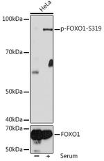Phospho-FOXO1 (Ser319) Antibody in Western Blot (WB)