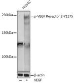 Phospho-VEGF Receptor 2 (Tyr1175) Polyclonal Antibody