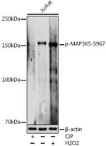 Phospho-ASK1 (Ser967) Antibody in Western Blot (WB)