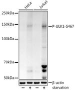 Phospho-ULK1 (Ser467) Polyclonal Antibody